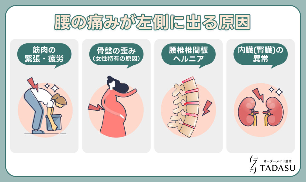 腰の痛みが左側に出る原因