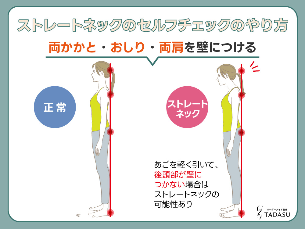 ストレートネックのセルフチェックの方法