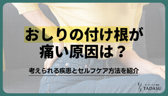 おしりの付け根が痛い原因は？考えられる疾患とセルフケア方法を紹介