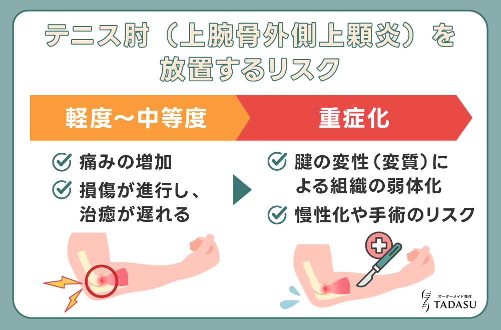 テニス肘(上腕骨外側上顆炎)を放置するリスク
